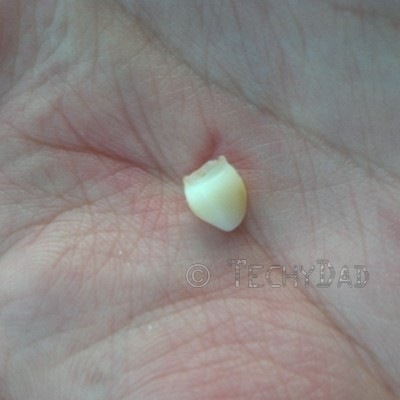 tooth-found