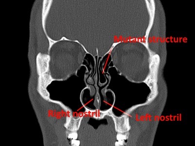 TechyDad's CAT Scan Annotated